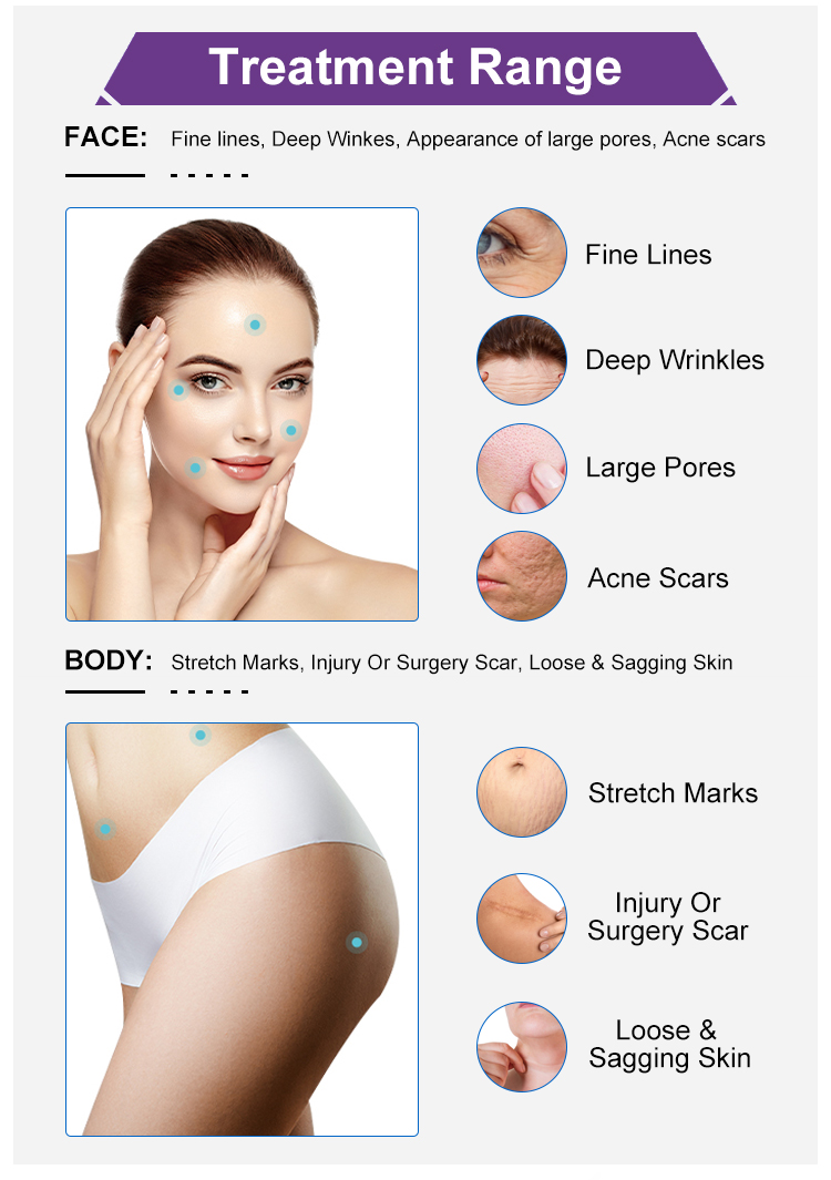 Skin Tightening RF Microneedling Machine