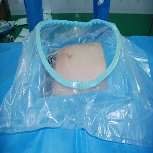 Disposable Sterile Surgical SSMMS SMMS C Section Pack