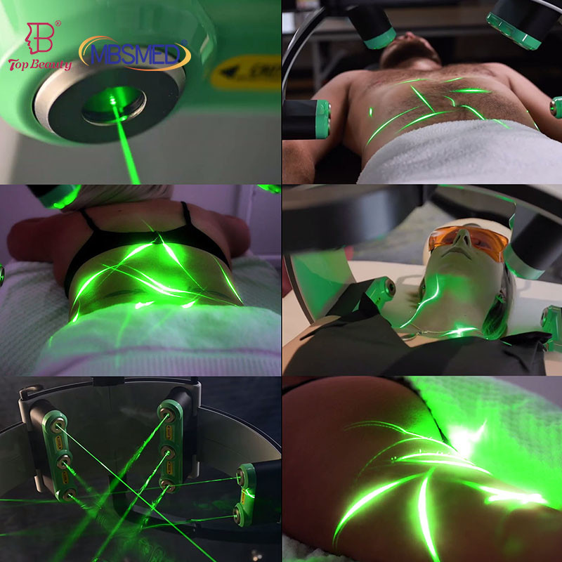 532nm Green Light Therapy Cold Laser Fast Slim Machine 10D Cellulite Reduction For Beauty Salon