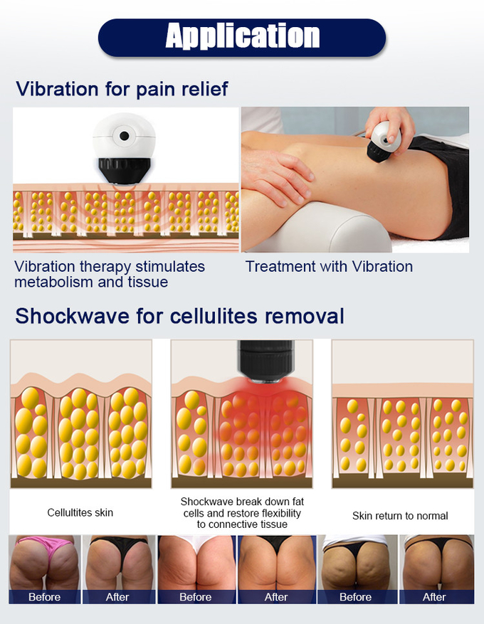 Vibration And Shockwave Massage Therapy Machine Slimming Body Multifunctions