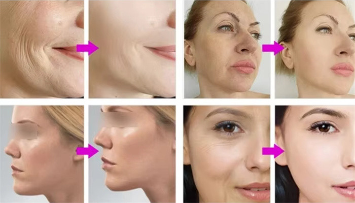 EMRF 3 In 1 Massager RET FACE Facial Lifting Firming Sculpting Electo Magenetic Body Slimmingting Machine