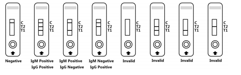 Colloidal Gold Based COVID-19 Test Kit For Negative Nucleic Acid Testing