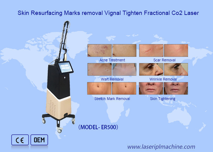 5MJ Fractional Co2 Laser Machine Wrinkle Removal Acne Removal