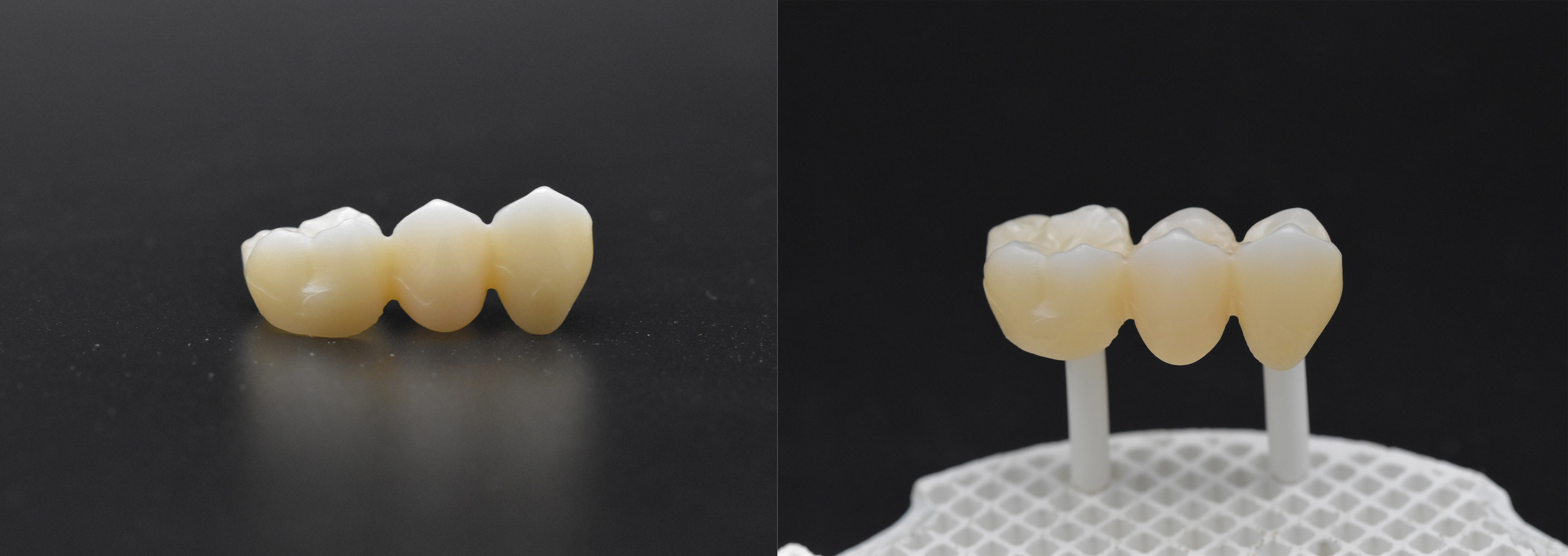 49% Ultra Translucent 98mm UT Dental Zirconia Block For Anterior
