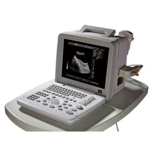 12 Inch Notebook Portable Ultrasound Scanner With Window 10 system(PC)
