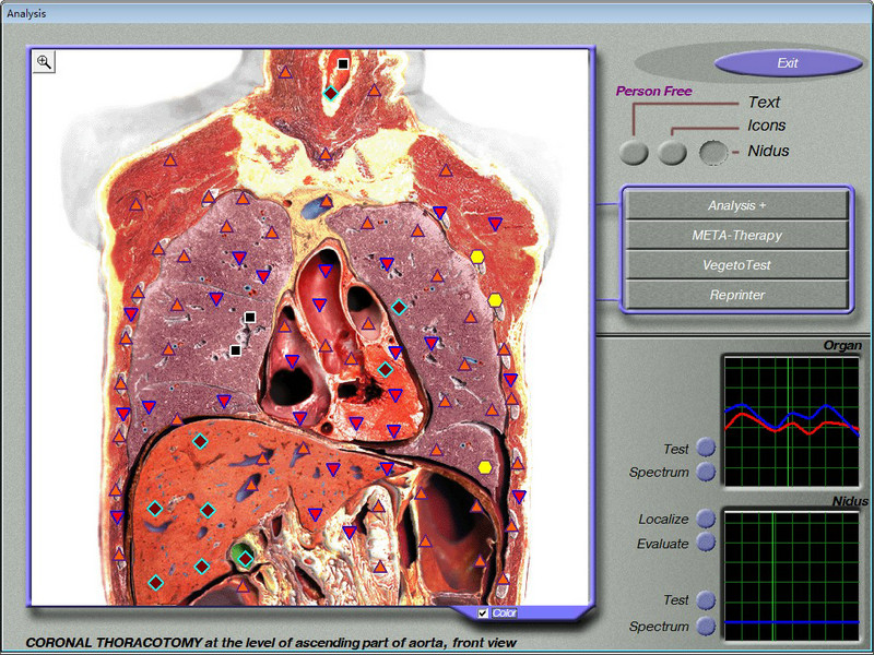 Portable Body Composition 3d Nls Health Analyzer Testing Machine