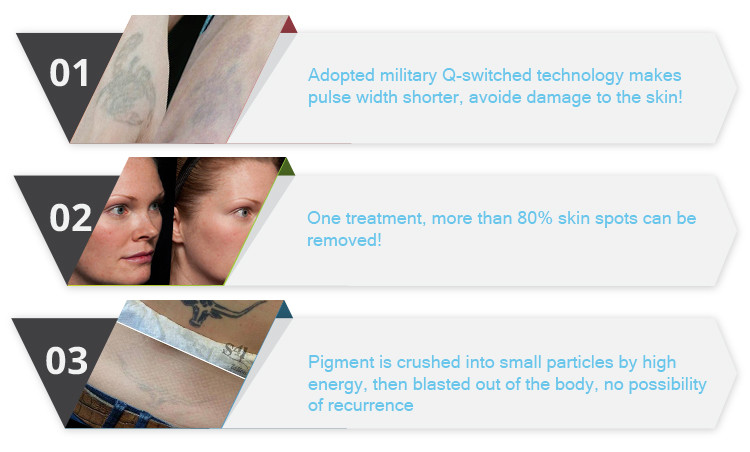 New arrival professional laser nd yag q-switched nd yag long pulse laser tattoo removal machine for sale