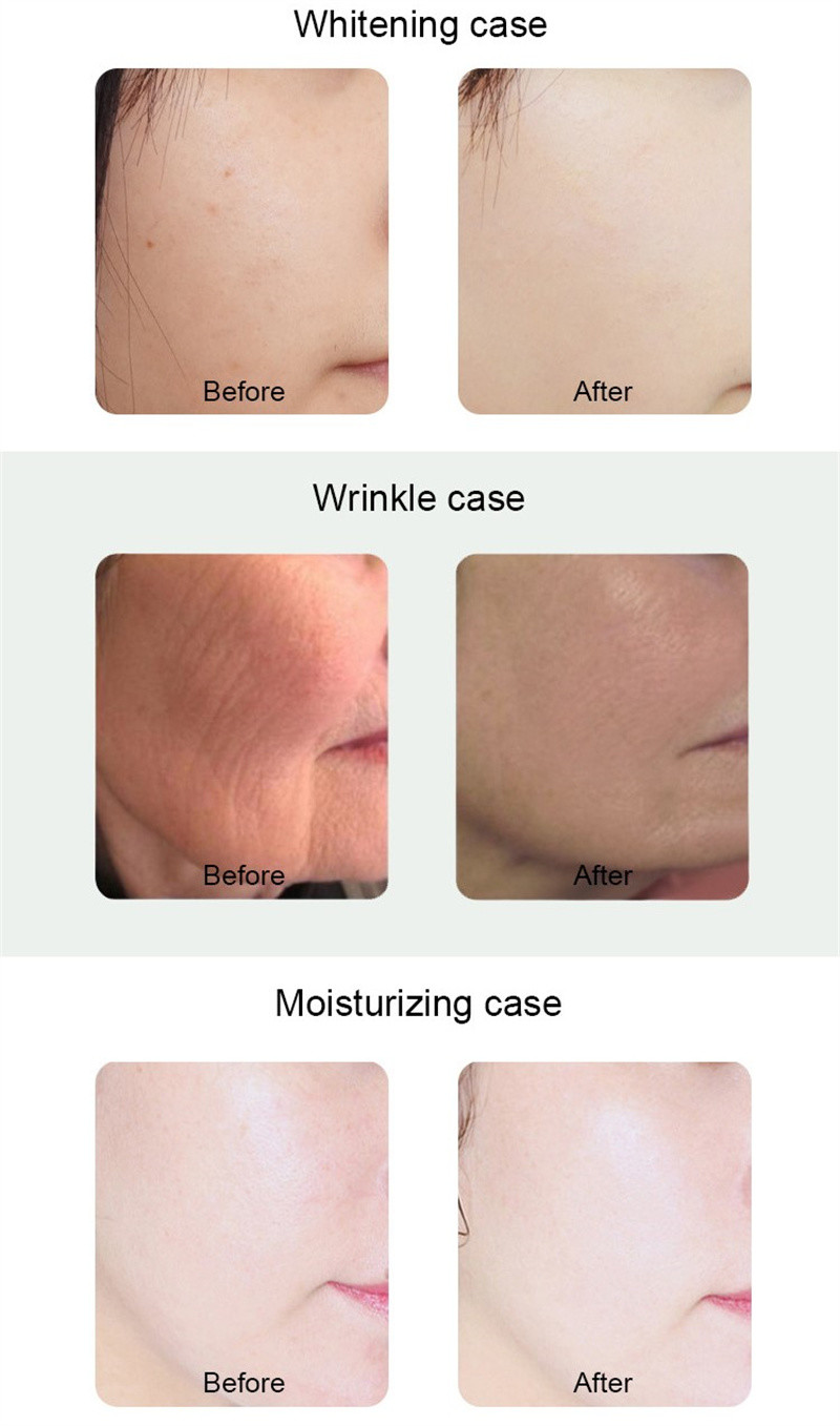 Multifunctional 6 In 1 Hydrafacial Machine Cleansing Facial Care Skin Rejuvenation