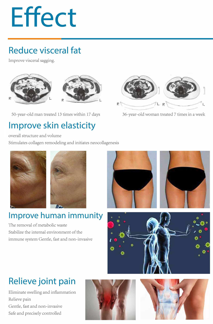Pain Relief Salon Skin Rejuvenation Laser Machine Portable Alexandrite Nd Yag Laser Hair Removal