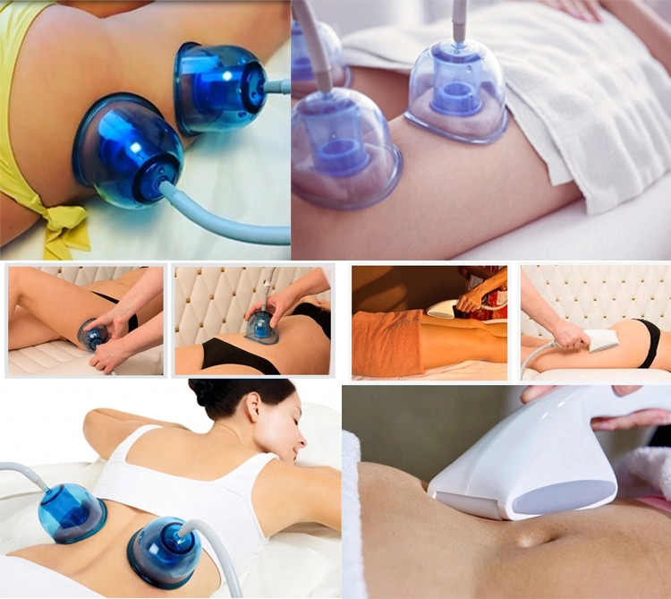 Starvac Sp2 OEM Vacuum Cupping Machine For Cellulite