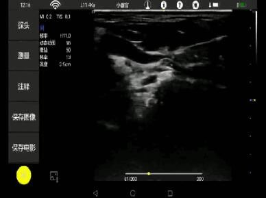 Portable Ultrasound Machine Probes Wireless Ultrasound Probe with 2~11MHz Frequency 160g Weight Only