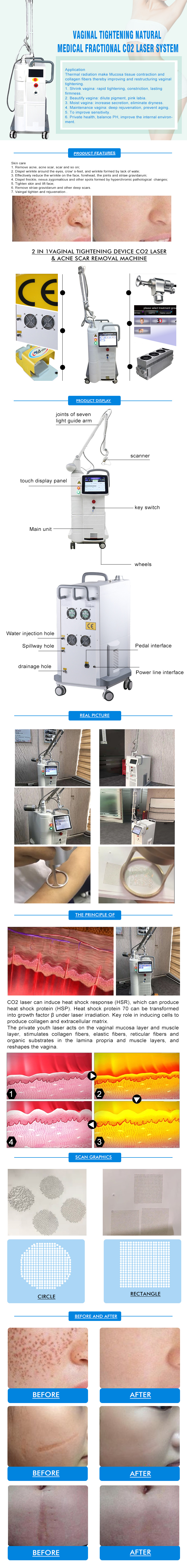 Latest 2022 Laser Equipment Co2 Fractional Fractional Co2 Laser Co2 Fractional Laser Machine