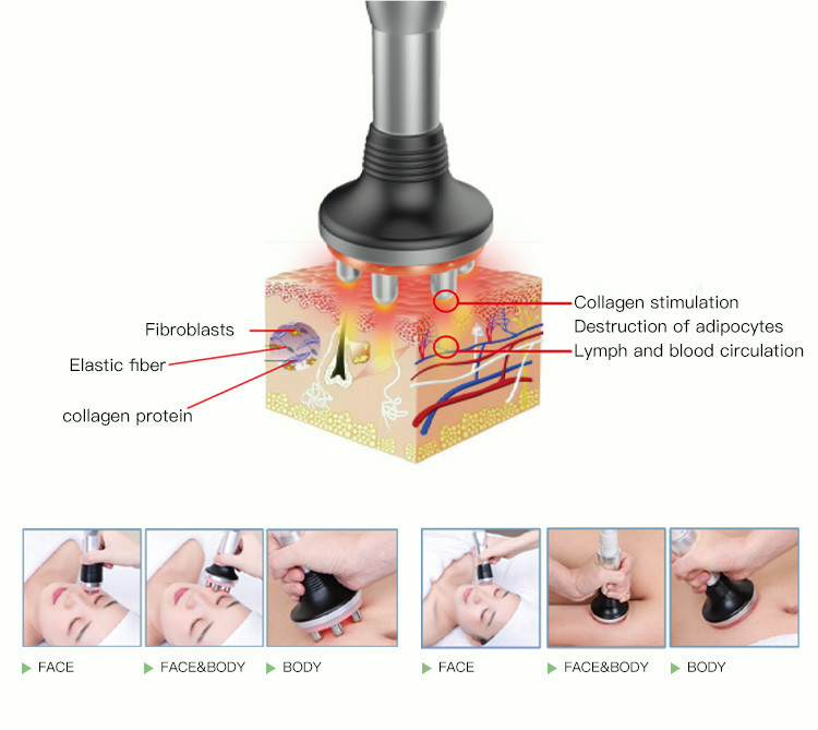 Beauty Care Ultrasound Cavitation RF Machine S Shape Cavitation Machine