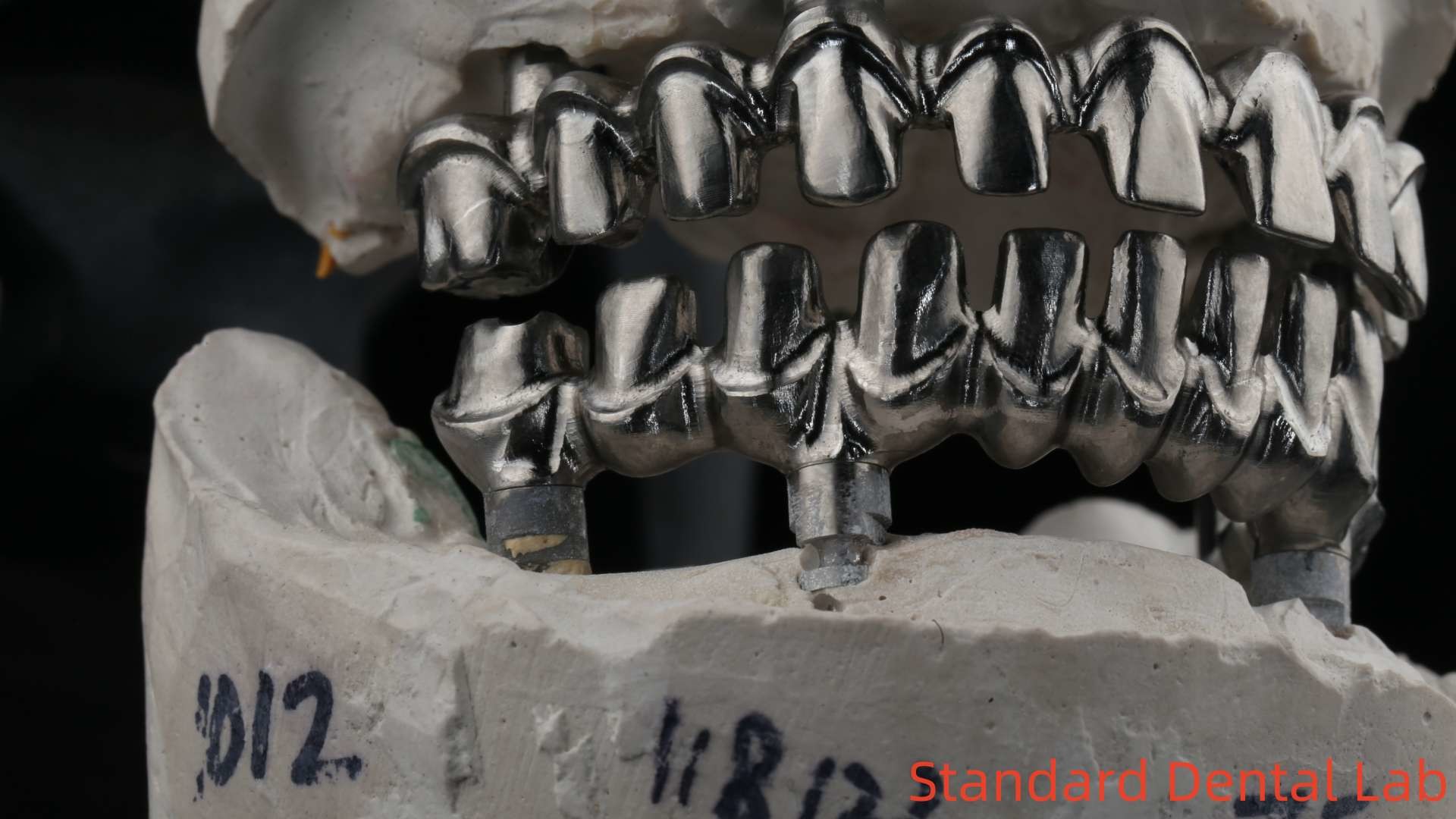Dental Hybird Malo Implant Bridge Professional Perfect Fit FDA Certified