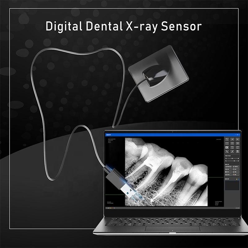 USB Multipurpose X Ray Dental Machine , Wireless Handheld Dental X Ray Unit