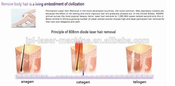 diode laser hair removal machine for beauty salon ＆beauty clinic