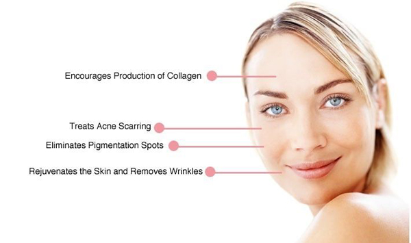 RF Face Lifting fractional micro needle max 50MHz infini rf output treatment Face lifting fractional rf machine