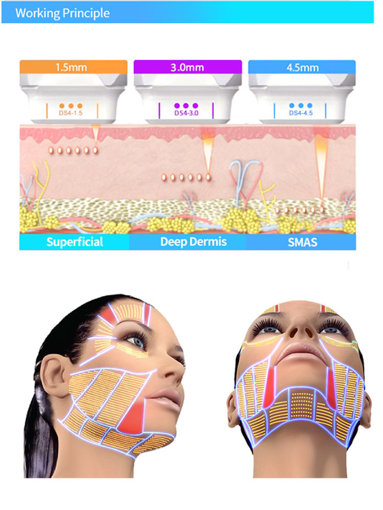 4D White Hifu Beauty Machine M001 20000 Shots Cartridge 12 Line Hifu Body Machine