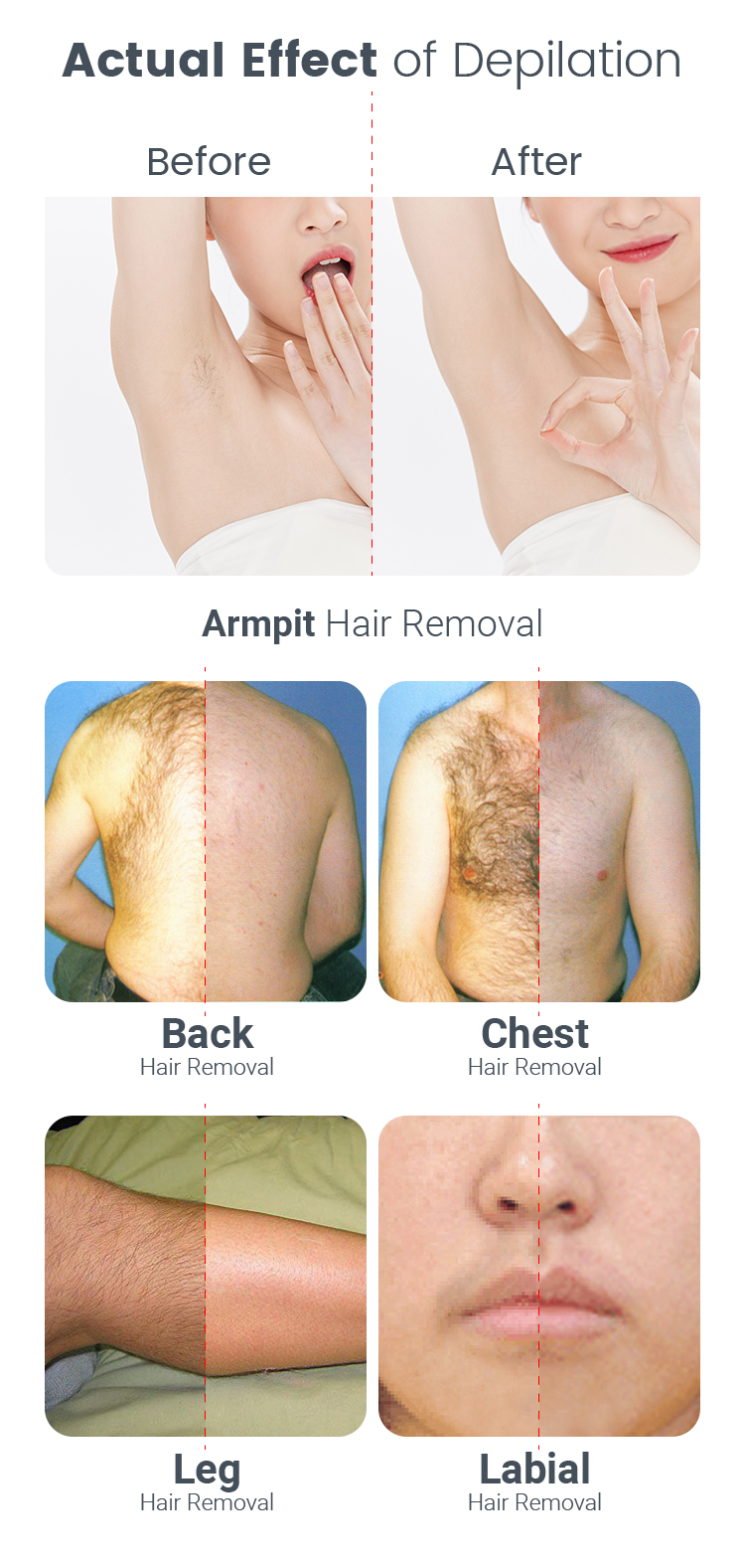 Style Portable 755nm 808nm 1064nm Wavelength Ice Diode Laser Mini Hair Removal Machine