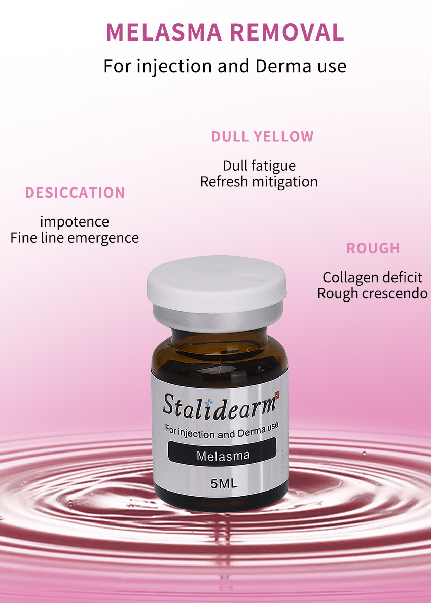 Stalidearm Dermal Fillers Improve The Look Of Freckle Facial Skin Care Melasma Treatment