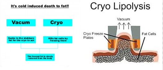 Most professional 3 technology best result body slimming face lifting Cryolipolysis machine