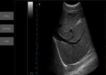 Ultrasound Scan Equipment Portable Ultrasound Scanner Palm Ipad Ultrasound Machine