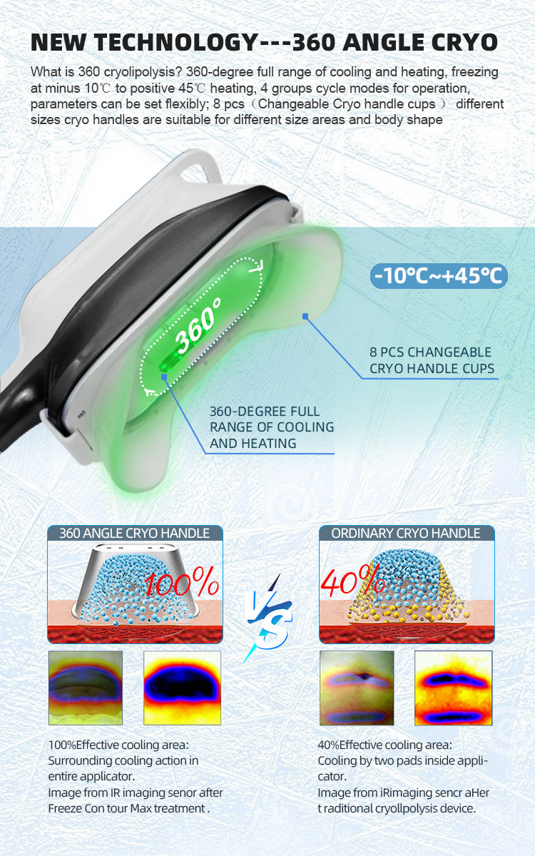 360 Cryo 40K Cavitation Body Sculpting With Double Chin Handle For Cellulite Removal