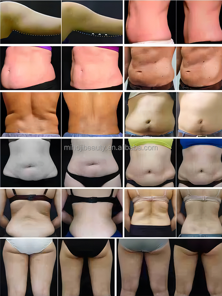 8 Handles Cryolipolysis Slimming Machine with 10.4 Inch LCD Display Screen