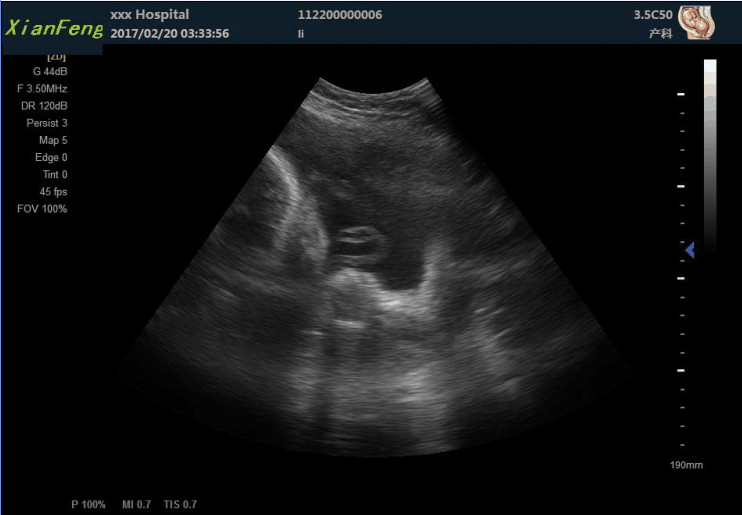 10.4" HD USG Scan Machine Color Doppler Ultrasound Scanner SVGA Output