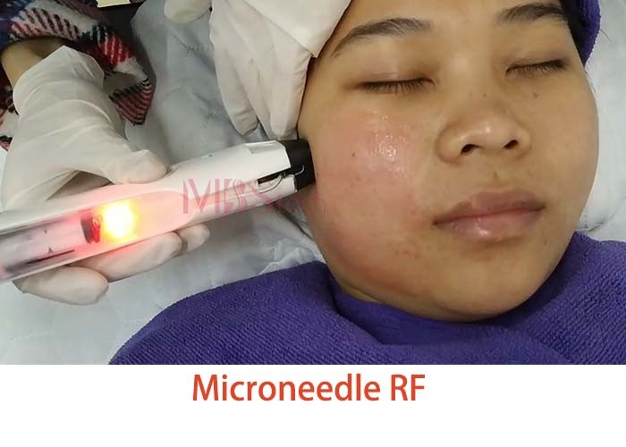 Mesotherapy Skin Face Lift Fractional Microneedle RF Machine