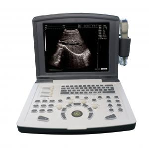  Portable Full Digital Diagnostic Ultrasound scanner OEM Manufactures
