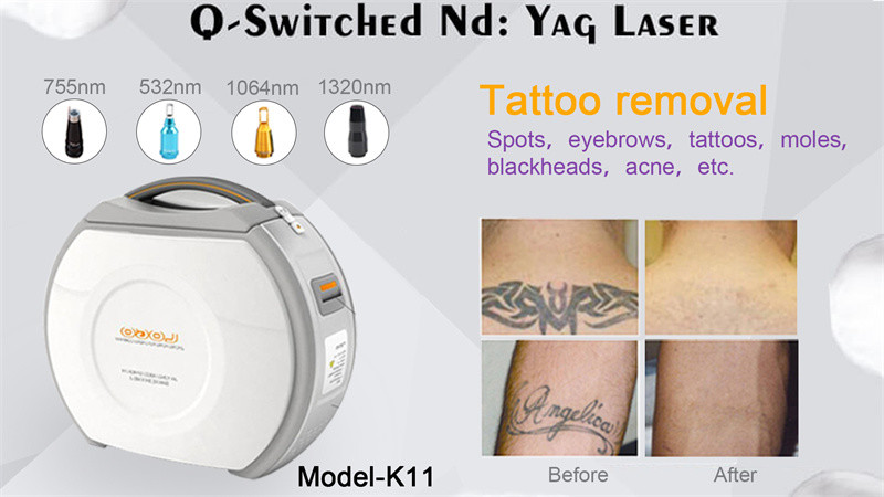 532nm Suitcase Laser Tattoo Removal Machine Q Switched Nd Yag