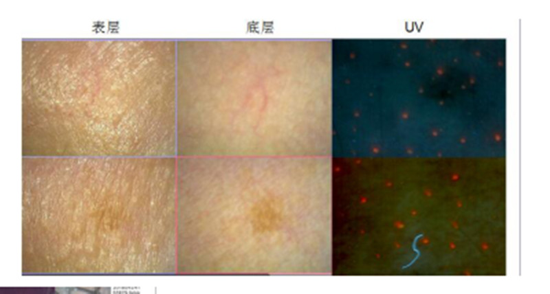 Beauty Portable Skin Analyzer Hair Analyzer Scanner Machine