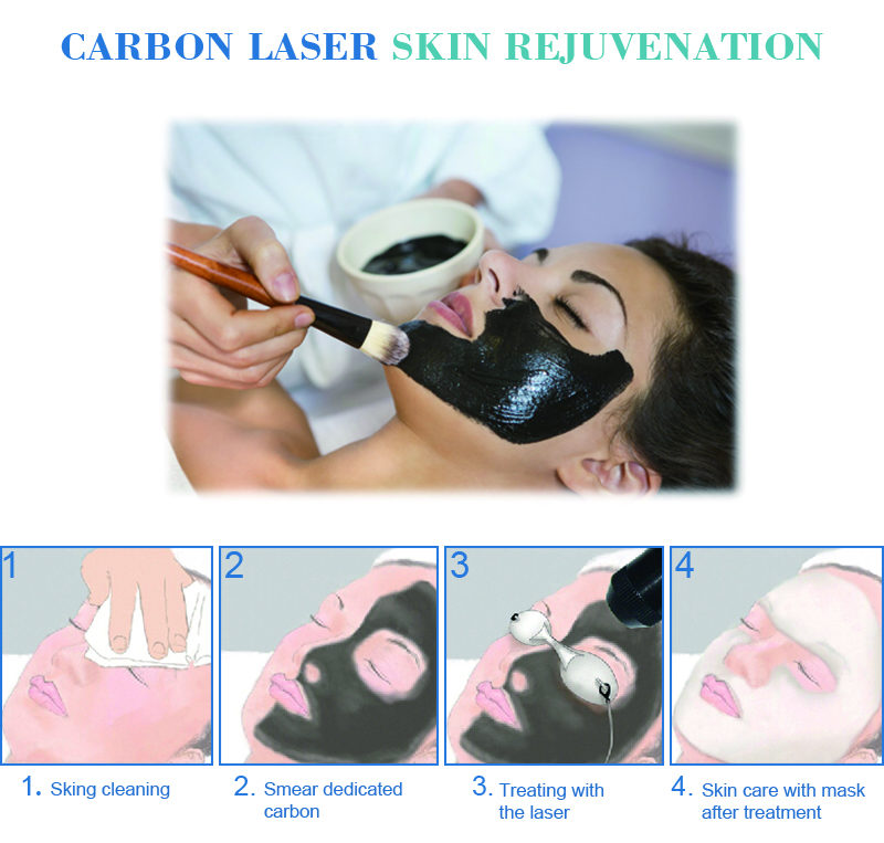 Produced high quality picosecond machine 1064nm laser removal tattoo for beauty equipment