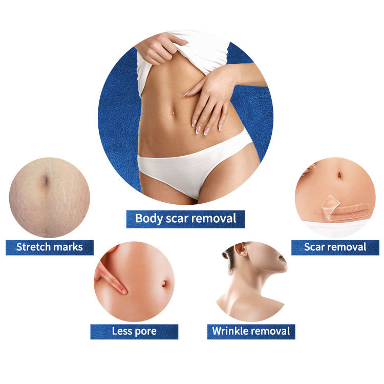 Salon 50W Radio Frequency Microneedling Machine Skin Tightening