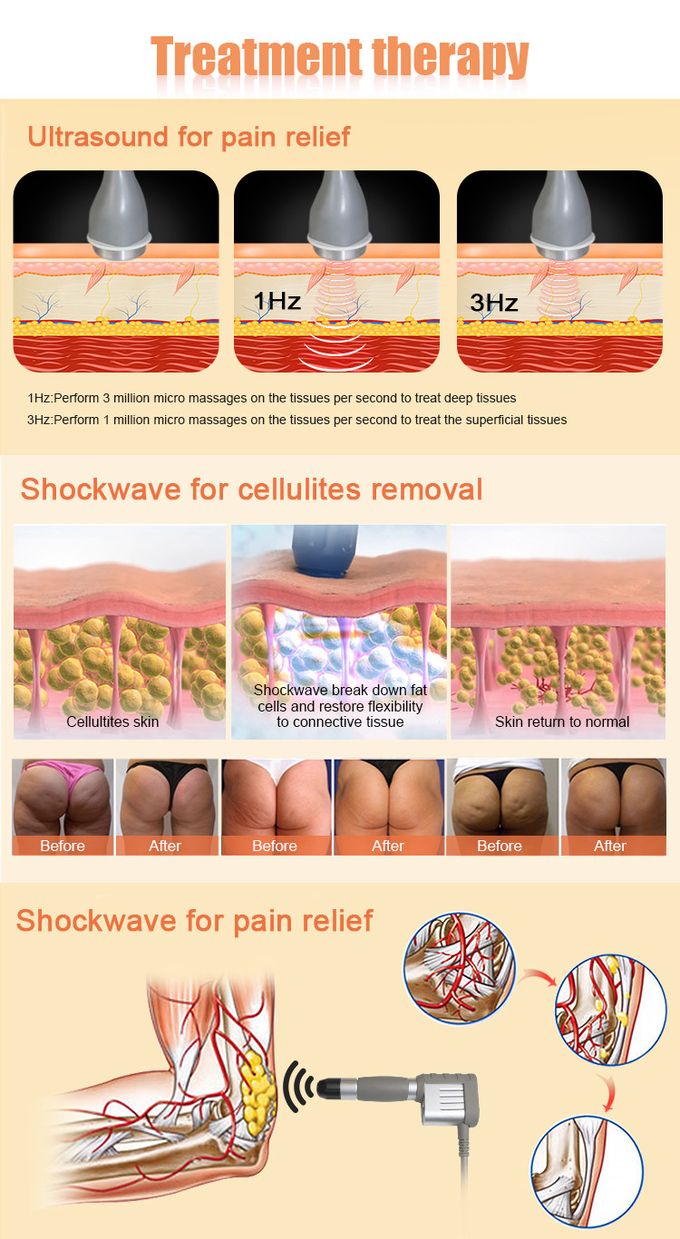 ABS Focused Shockwave Therapy Machine With Pulse / Continuous Ultrasound Mode