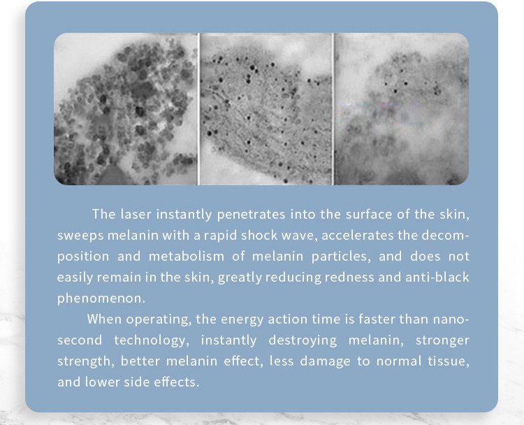 2500w Salon Picosecond Laser Tattoo Removal Machine For Pigmentation Remove