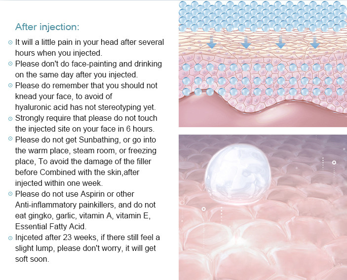 Experience Perfect Pout With HYDROIAM Kiss Lip Augmentation RED LIP Hyaluronic Acid Gel With B12
