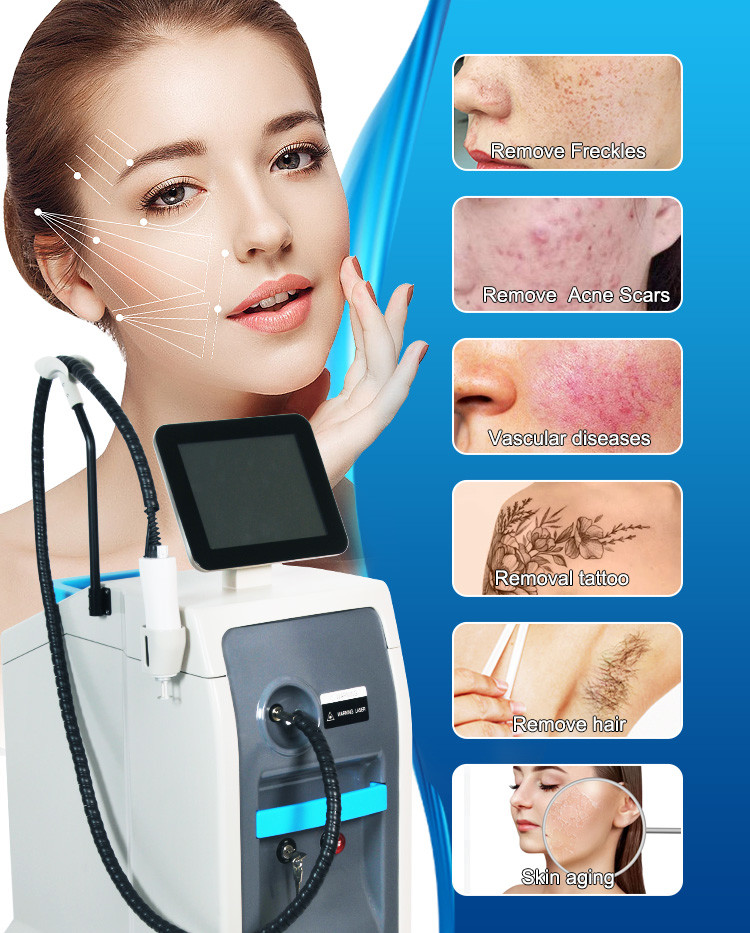 755nm Alexandrite Laser Machine 4hz Frequency Nd Yag Laser Machine