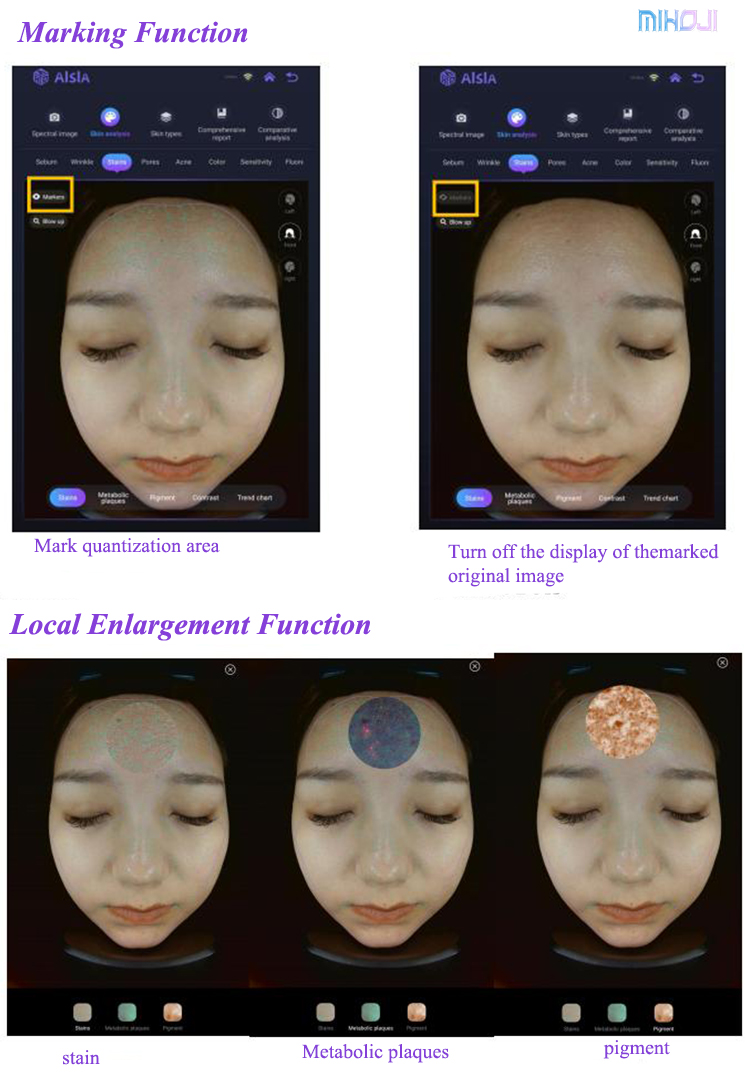 Black/ White Skin Test Analyzer Korean Skin Analyzer Facial Analyzer for Face Target Area