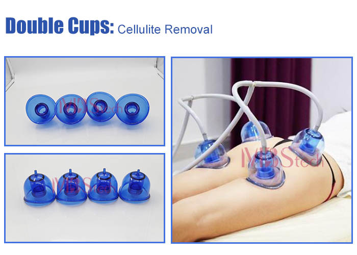 Vacuum Therapy Cup Roller Body Slimming vacuum roller rf machine Equipment