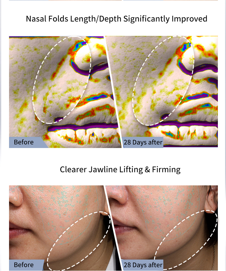 RF EMS Electric Vibrating Facial Massager Personal Care Skin Lifting