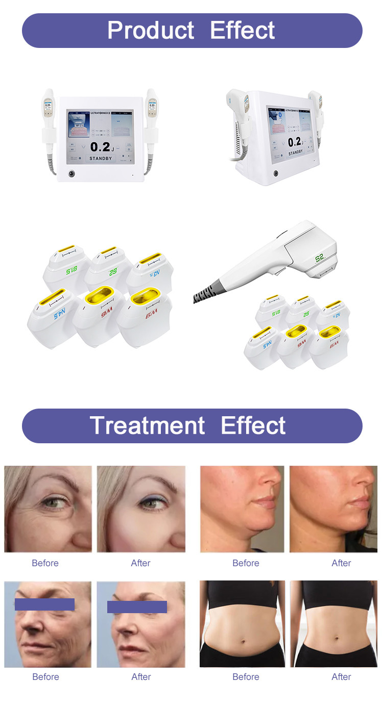 15 Inch Touch Screen HIFU Machine AS-HF-7d with 7 Cartridges for Non Surgical Face Lift