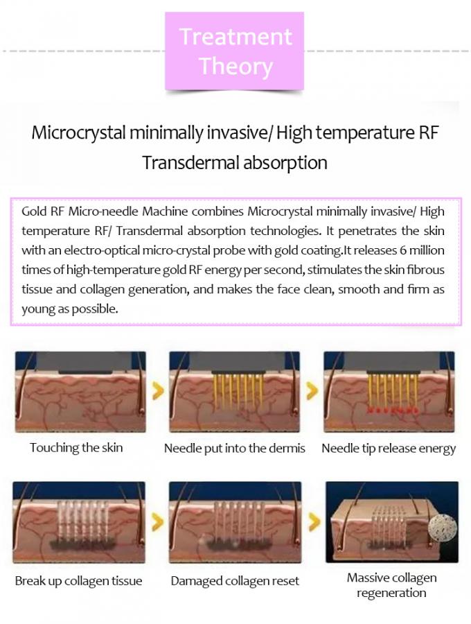 Skin Tightening Devices Wrinkle Reduction Salon  & Clinic RF Beauty Equipment 0