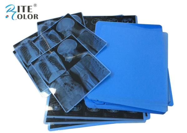 11 X 14 Inch Laser Imaging Film A4 PET Inkjet Medical Dry X Ray Film For CT CR