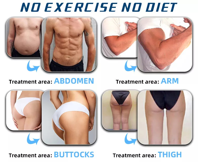 Body Sculpting Neo Machine 4 Handles Inewtech