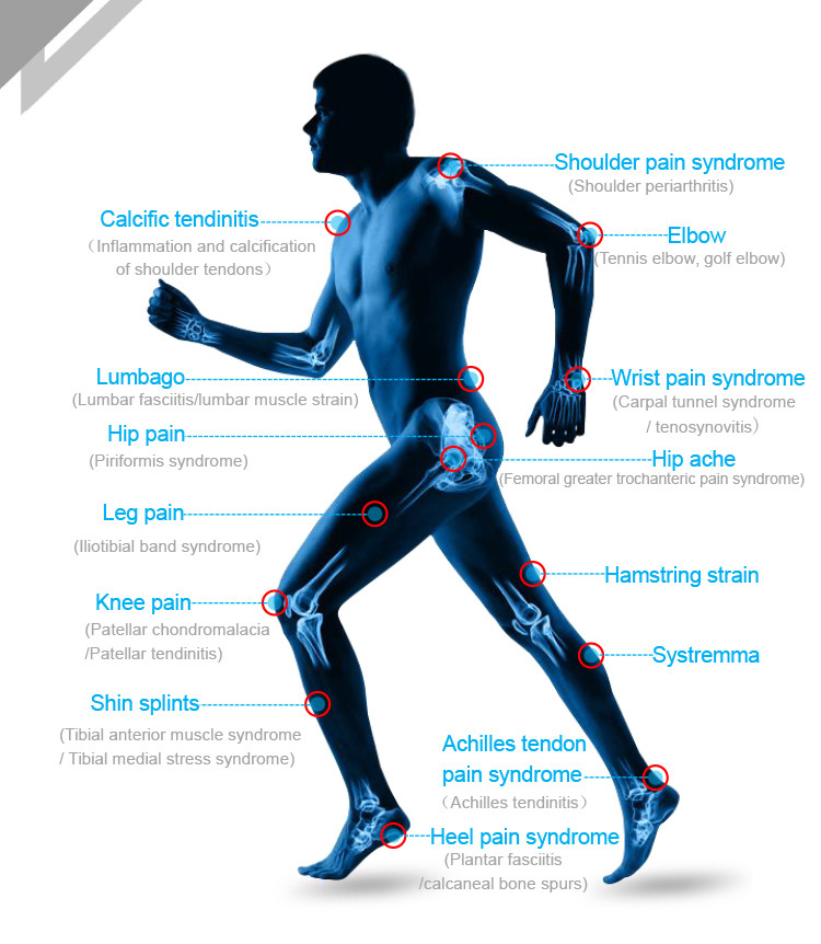 Shockwave Therapy Machine Focus Shockwave Physiotherapy Pain Relief Achilles Tendonit Therapy Physical Therapy Equipment