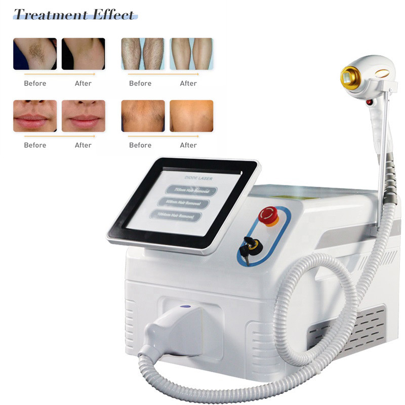 808nm 1064nm 755nm Diode Laser Super Hair Removal Machine 1500W Beauty Instrument