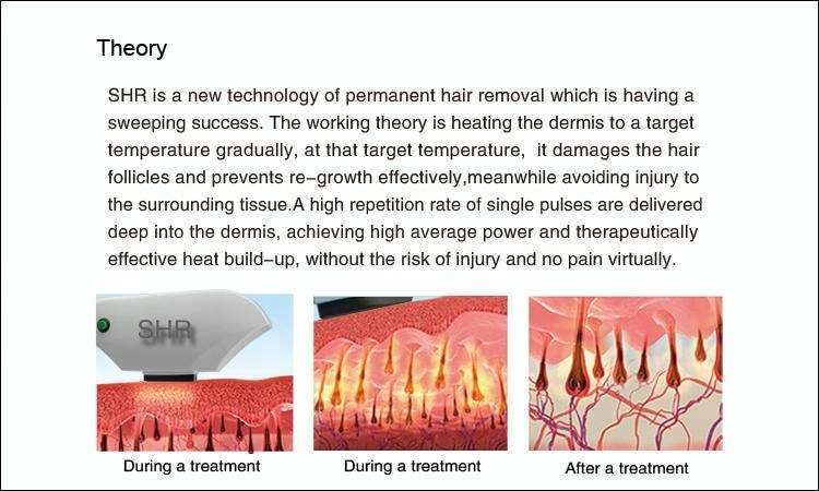 2 Handles Multifunction IPL Machine , OPT SHR Laser Hair Removal Machine
