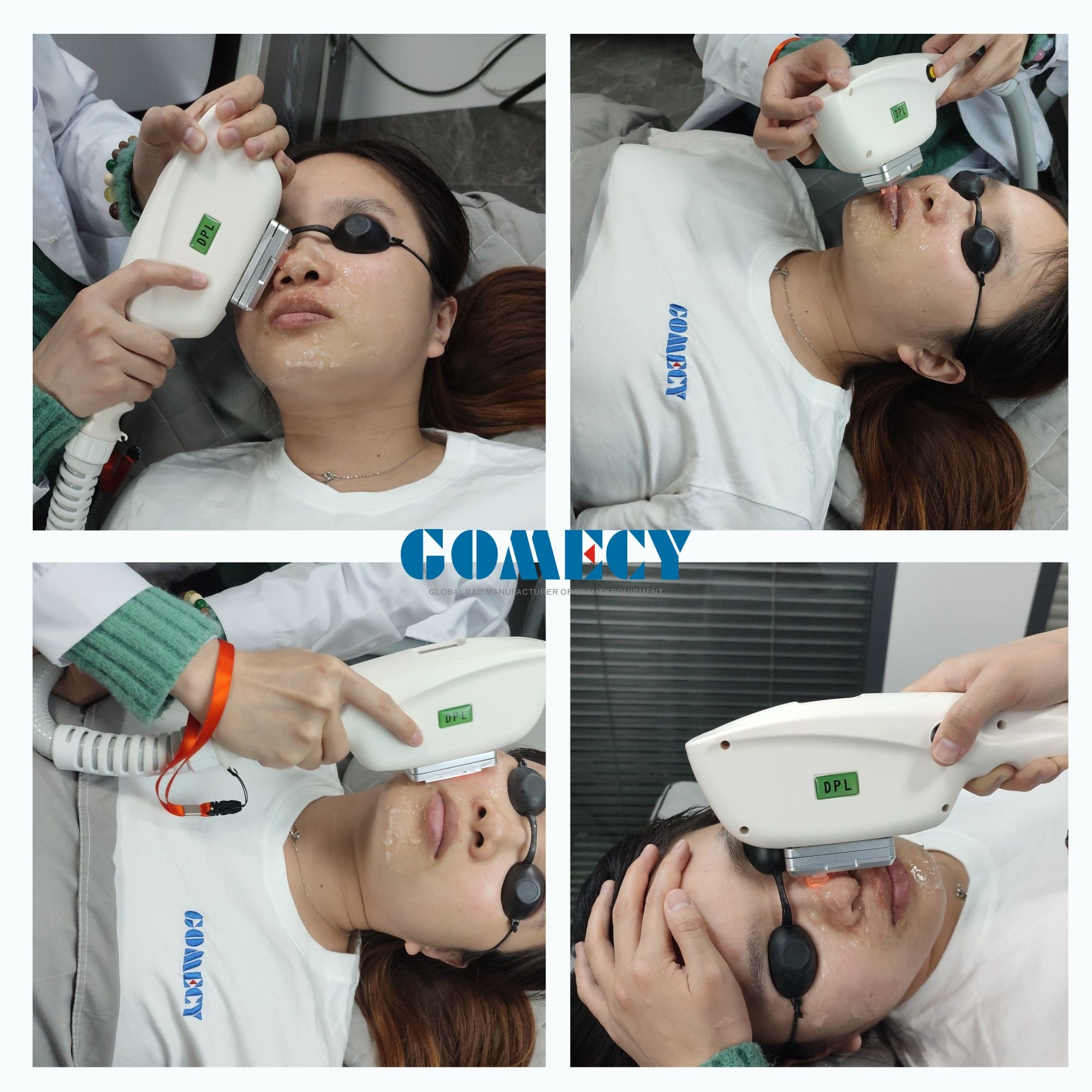 Ipl Shr Hair Removal Machine For Vascular Lesions And Facial Blemish Removal